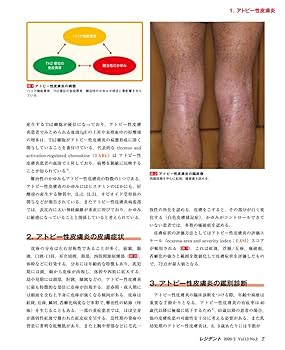 【裁断済み】 誤診されている皮膚疾患 Amazon.com: 内科で役立つ 一発診断から迫る皮膚疾患の鑑別診断
